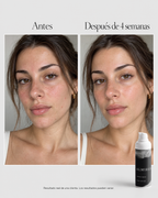 2% Vitamin C Serum