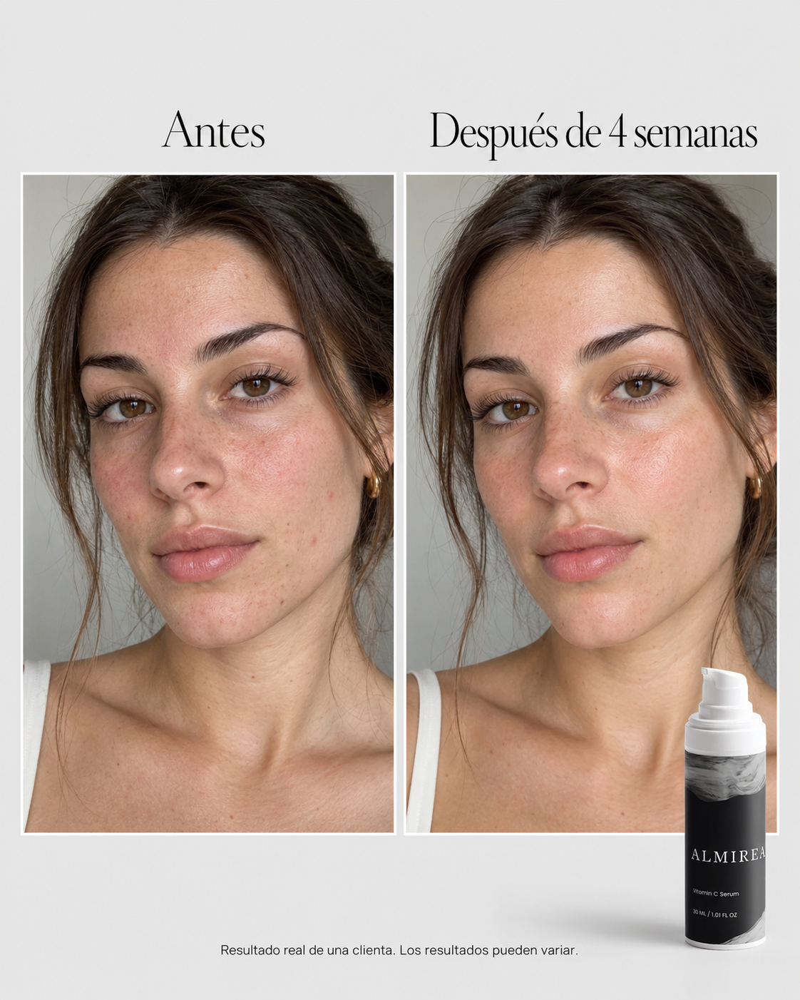 2% Vitamin C Serum